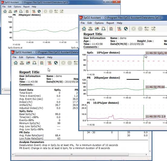 Produktbild Contec CMS50F 24h