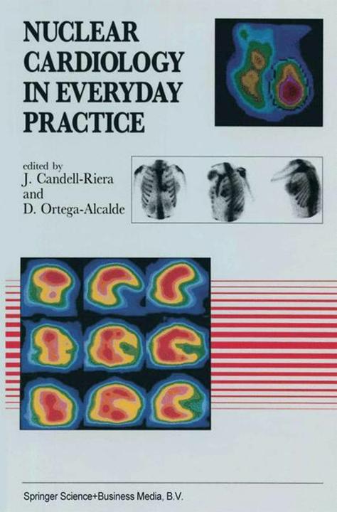 Actual product image Nuclear Cardiology in Everyday Practice (English, J. Candell-Riera, D. Ortega-Alcalde, 2012)