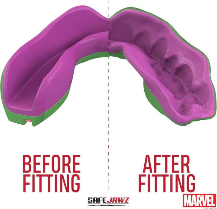 Actual product image SafeJawz Marvel The Hulk mouthguard