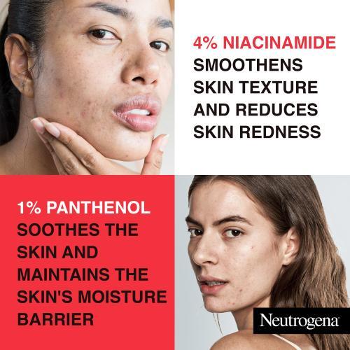 Actual product image Neutrogena Clear & Defend+ Gel Moisturiser (50 ml, Face gel)