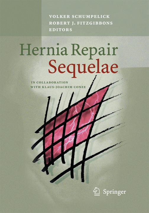 Produktbild Hernia Repair Sequelae (Volker Schumpelick, Robert J. Fitzgibbons, 2014)