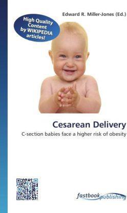 Actual product image FastBook Publishing Cesarean Delivery (Edward R. Miller-Jones, 2012)