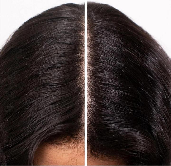 Image du produit Shu Uemura Essence Absolue Nourishing Soothing Scalp Oil Concentré (50 ml)