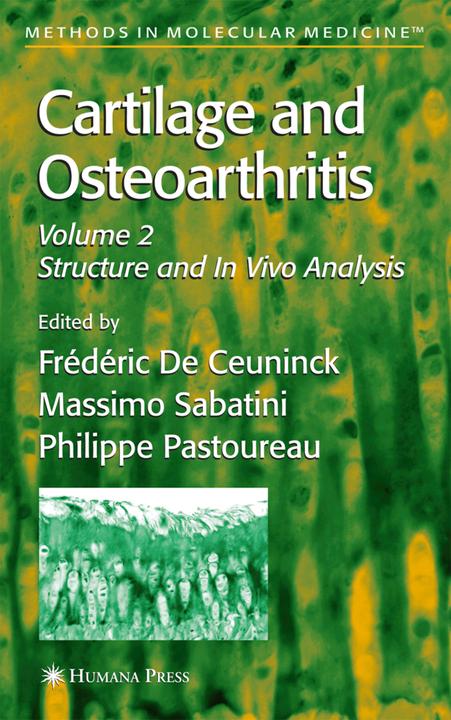 Produktbild Cartilage and Osteoarthritis (Englisch, Massimo Sabatini, Frédéric De Ceuninck, Philippe Pastoureau, 2010)