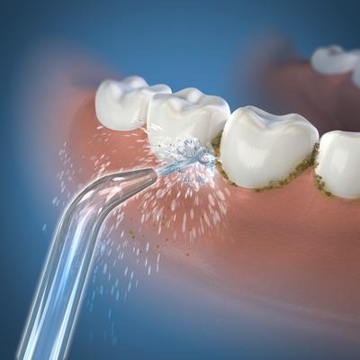 Produktbild Waterpik Wp60/70/90e (Mundduschenaufsätze)