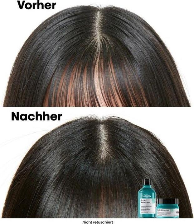 Produktbild L'Oréal Professionnel Scalp Advanced (250 ml)