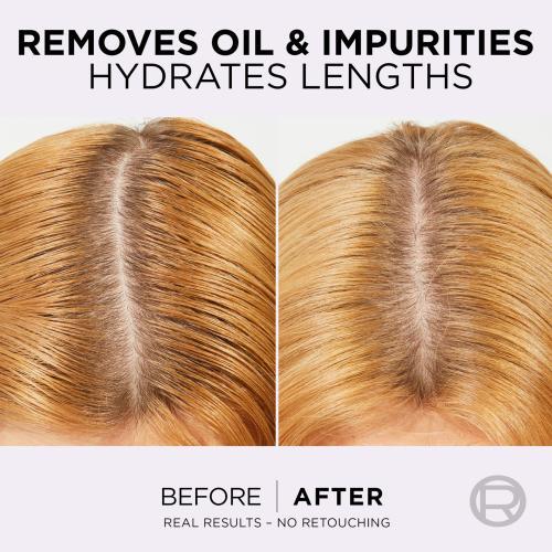 Immagine prodotto L'Oréal Paris Siero per il cuoio capelluto Elseve Hyaluron Pure Oil Erasing (102 ml)