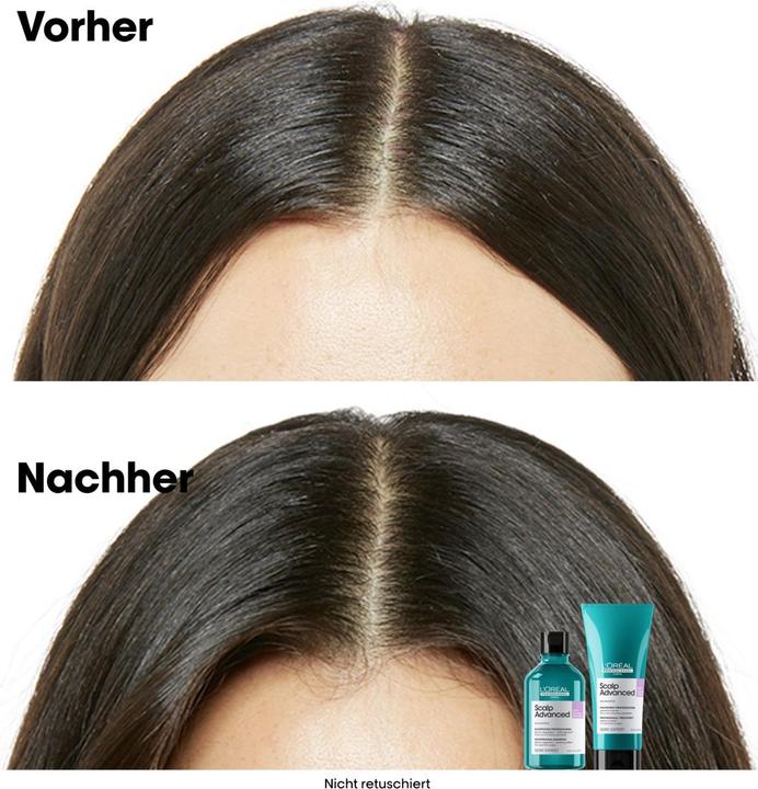 Produktbild L'Oréal Professionnel Série Expert Scalp Advanced - Anti-Discomfort Dermo-Regulator (500 ml, Flüssiges Shampoo)