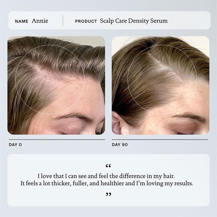 Image du produit Living Proof Scalp Care Density Serum 1.7 Fl Oz (50 ml)