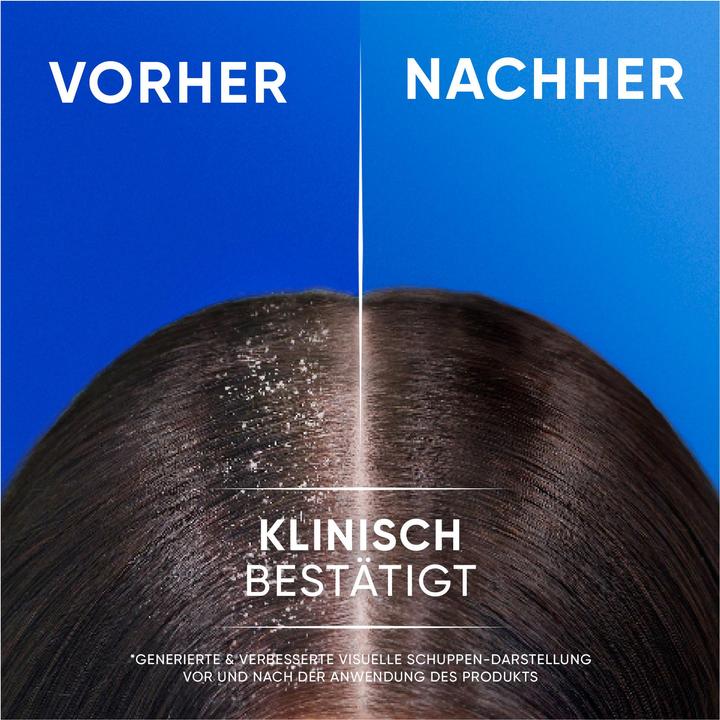 Image du produit Head & Shoulders Anti-Schuppen Shampoo 2in1 Citrus Fresh für fettiges Haar (800 ml, Shampoing liquide)