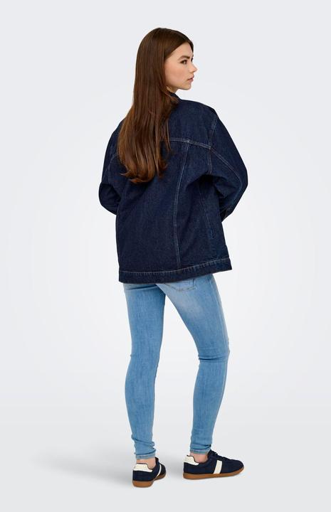 Produktbild Only ONLJAGGER Jeansjacke Jeansjacke (XL)
