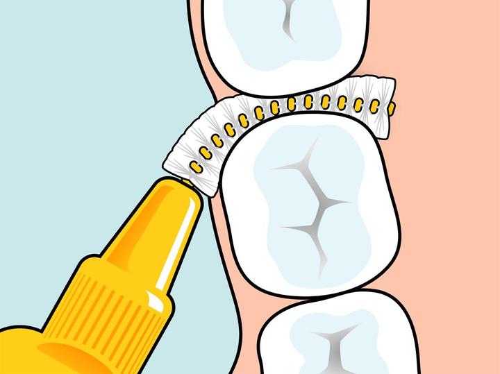 Image du produit TePe Interdentalbürsten Original Orange ISO 1 (8 x, 0.45 mm)