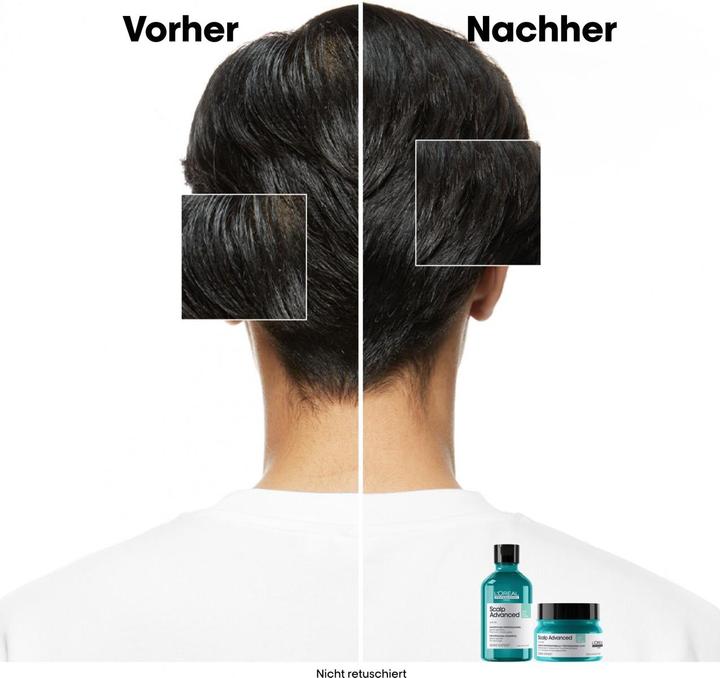 Produktbild L'Oréal Professionnel Scalp Advanced (250 ml)
