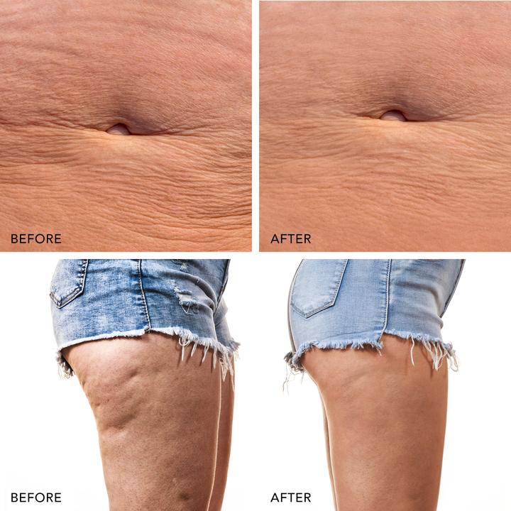 Produktbild Foreo Mikrostromgerät