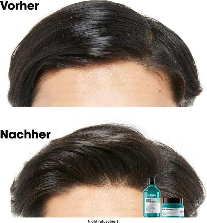 Produktbild L'Oréal Professionnel Scalp Advanced (250 ml)