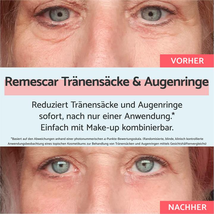 Actual product image Remescar Eye bags and dark circles (Crème, 8 ml, Day + Night)