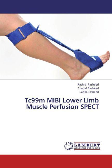 Produktbild Tc99m MIBI Lower Limb Muscle Perfusion SPECT (Deutsch, Saqib Rasheed, Shahid Rasheed, Rashid Rasheed, 2013)