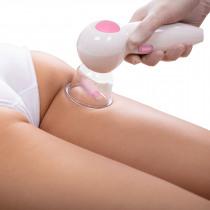 Actual product image Cosmetic Club Cupping glass
