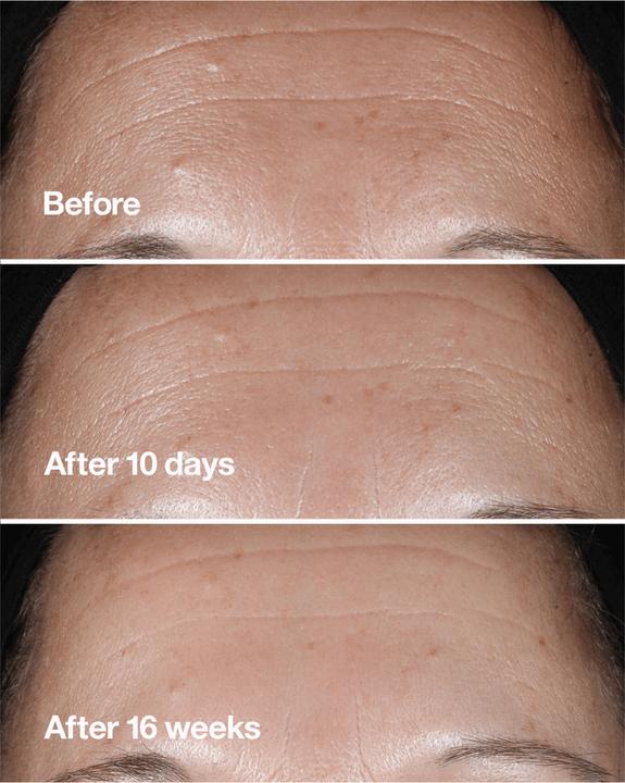 Produktbild Clinique Smart CliNight Repair Wrinkle Serum (75 ml)