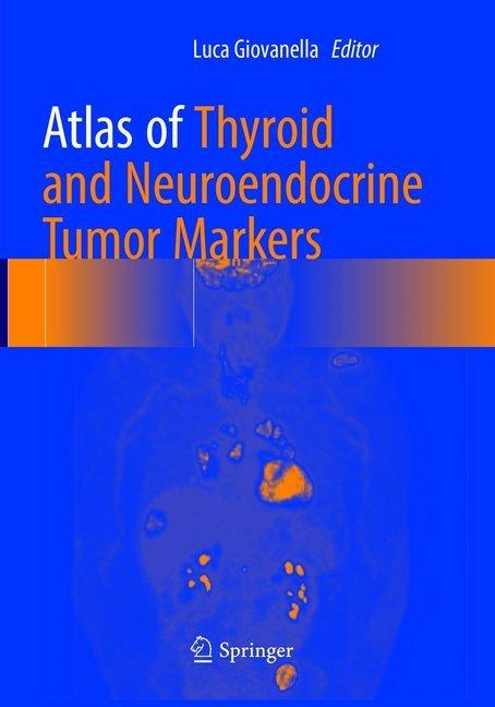 Immagine prodotto Atlas of Thyroid and Neuroendocrine Tumor Markers (Luca Giovanella, 2019)