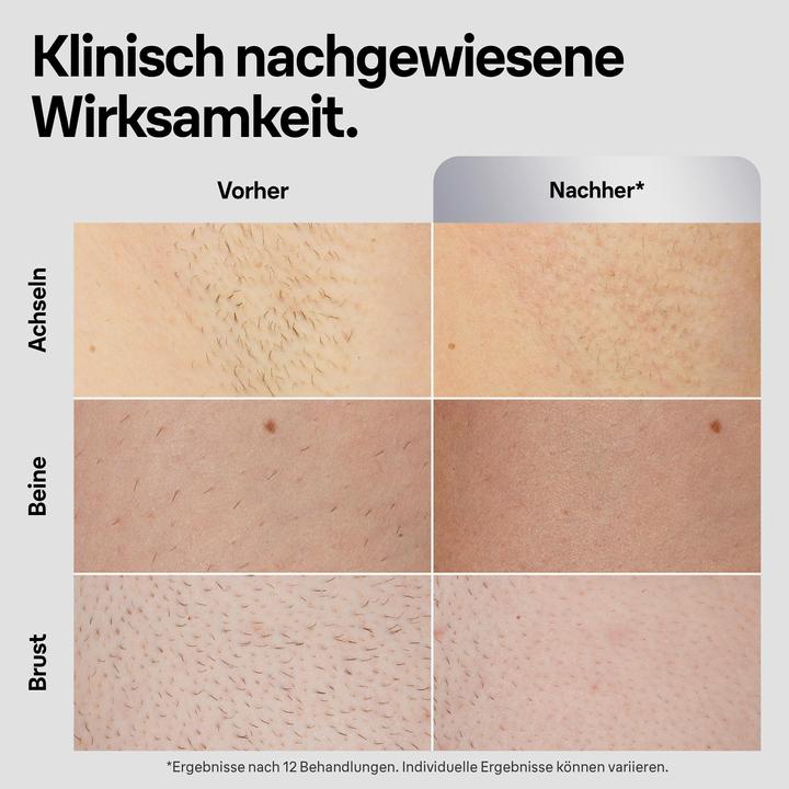 Image du produit Braun Silk-expert Pro 5