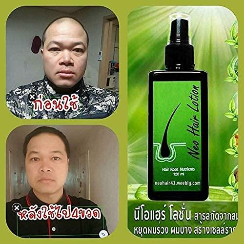 Produktbild Neo Haarwachstumsmittel (120 ml)