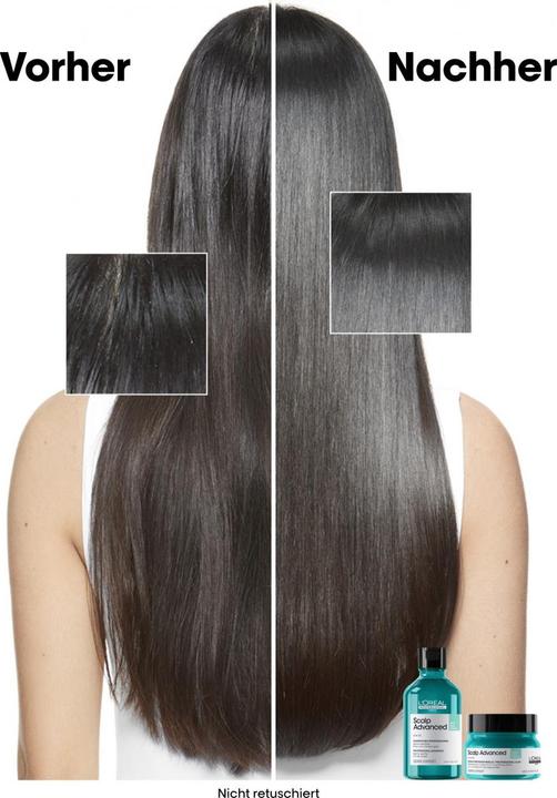 Produktbild L'Oréal Professionnel Scalp Advanced (250 ml)