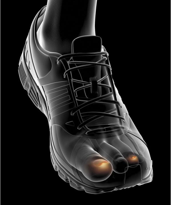 Image du produit Epitact Capuchons de protection pour le sport ongles bleus EpitheliumTact 02, taille S 23 mm (S)