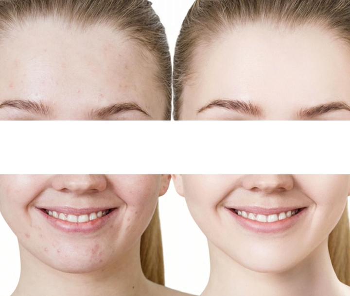 Produktbild Velform Vacu Clear