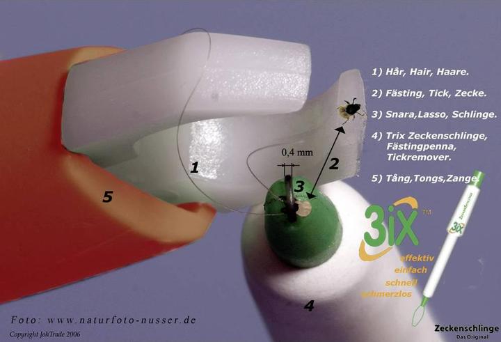 Produktbild 3iX Zeckenschlinge