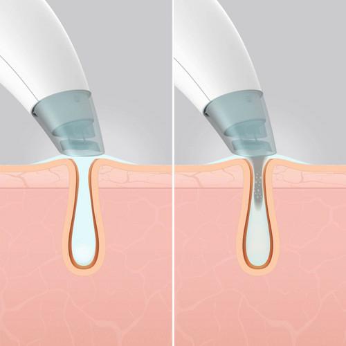 Actual product image Homedics Hydrafacial Cleanser