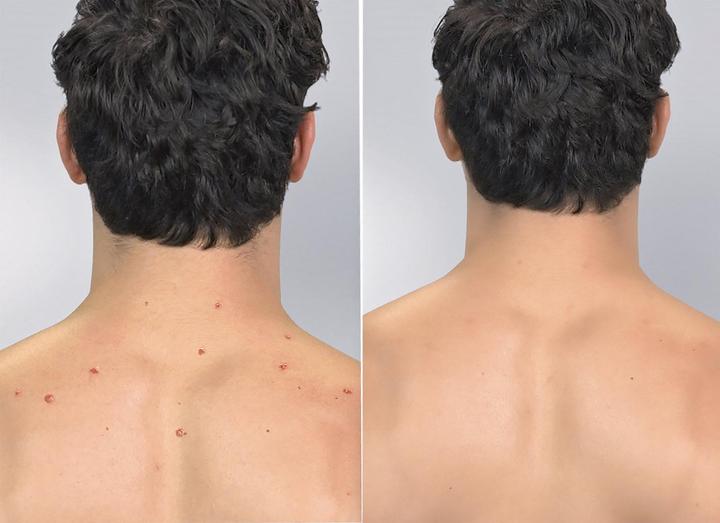 Produktbild MediaShop Derma Suction