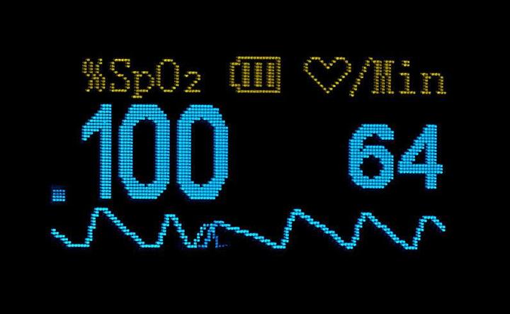 Actual product image Newgen medicals Finger pulse oximeter with OLED display and USB connection