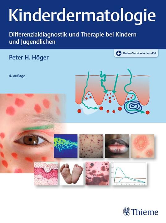 Actual product image Kinderdermatologie (German, Peter Höger, 2021)