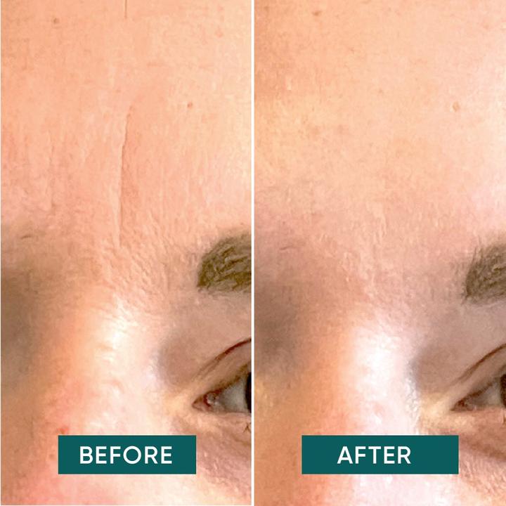 Produktbild Apricot Facial Patches Mini