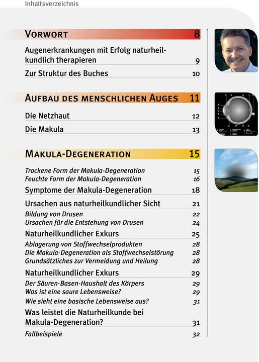 Actual product image Makula-Degeneration und Diabetische Retinopathie (German, Andreas Nieswandt, 2024)