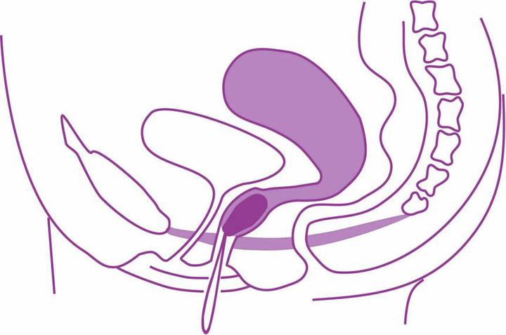 Actual product image Elanee Pelvic floor training aid